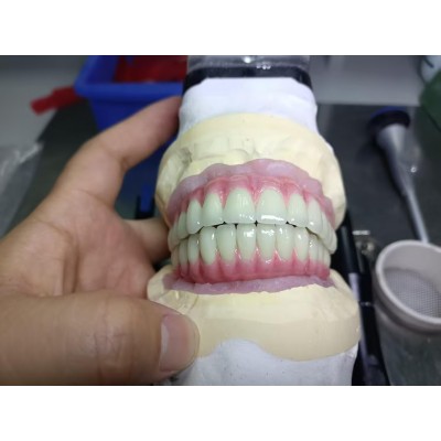 Cement Implant Crown And Bridge, Chinese Dental Laboratory