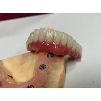 high-quality all-solid zirconia crowns and bridges, most suitable for Chinese dental laboratories
