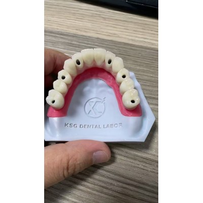 China Dental Crown Lab & Dental Implant Crown factories