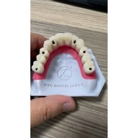 China Dental Crown Lab & Dental Implant Crown factories